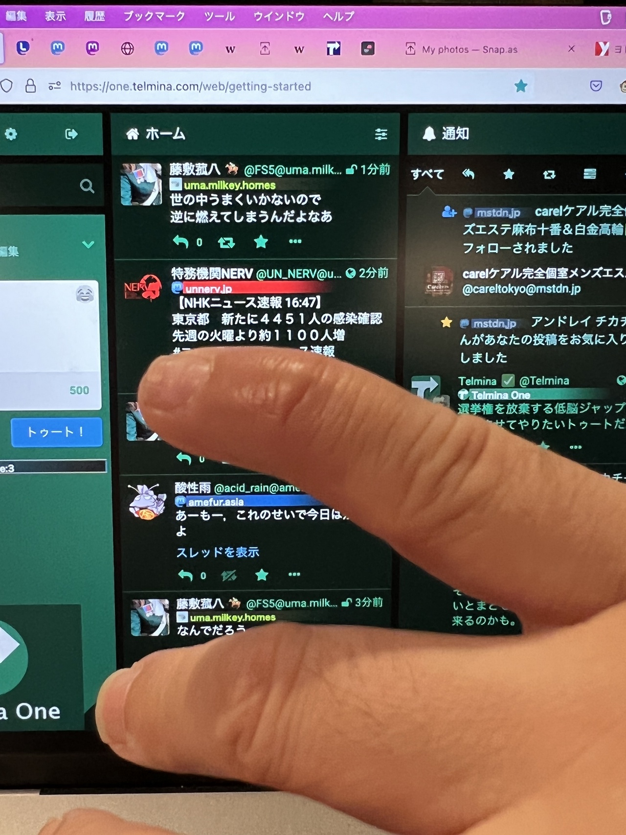 どう考えても曲がっているようにしか見えないテルミナ™の右å手小指